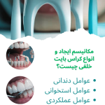 کراس بایت خلفی