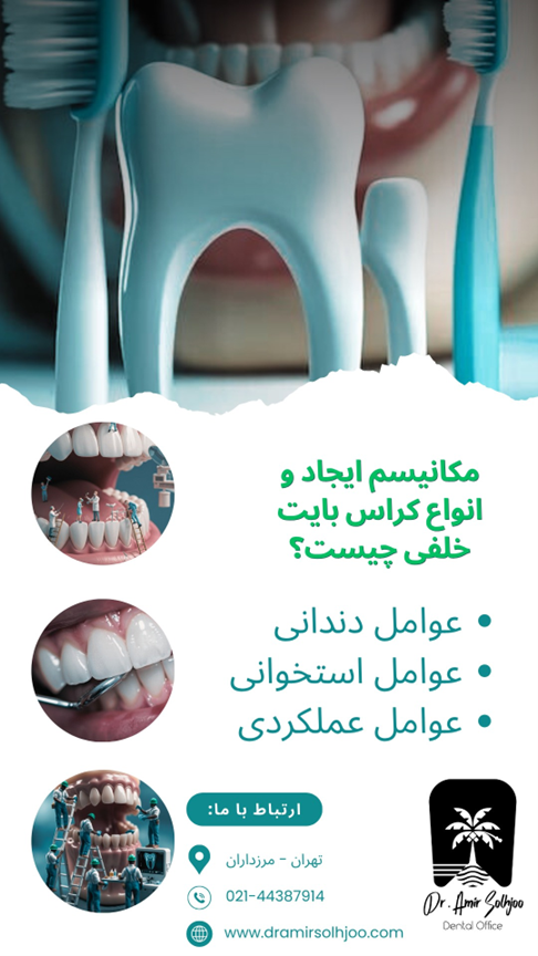 کراس بایت خلفی