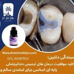 چسبندگی دنتین