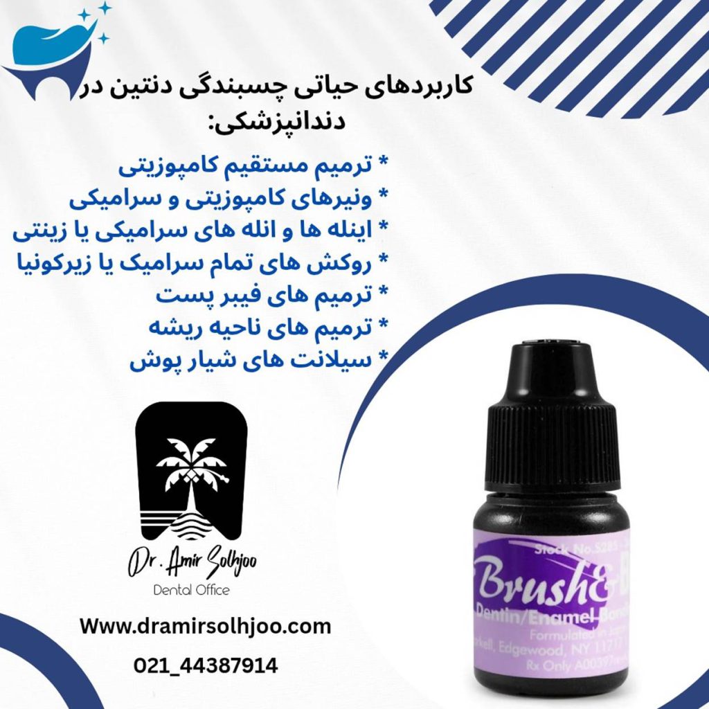 کاربرد چسبندگی دنتین