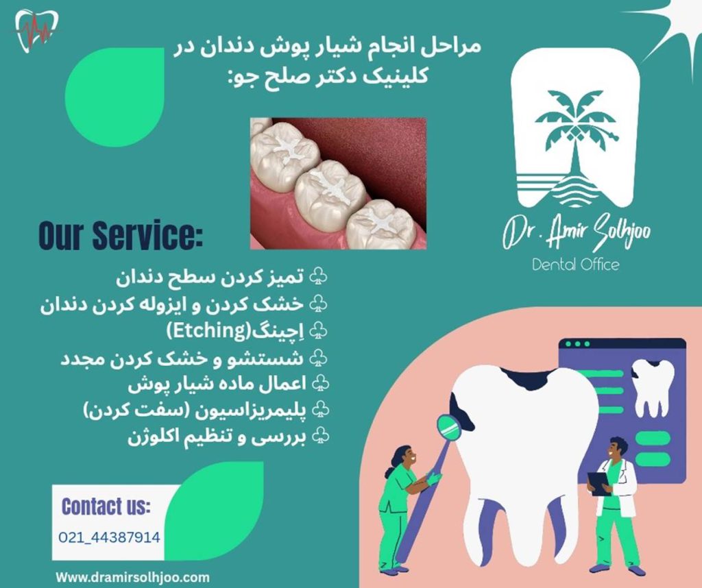 مراحل شیار پوش دندان