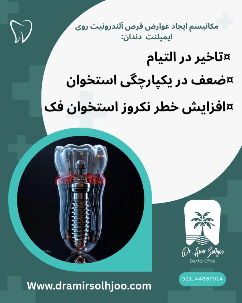 عوارض قرص آلندرونیت روی ایمپلنت دندان
