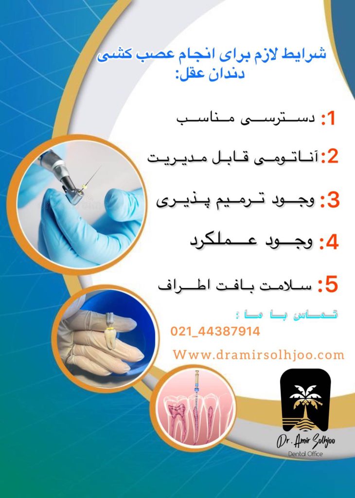 شرایط لازم برای عصب کشی دندان عقل