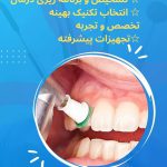 بهترین روش جرمگیری دندان