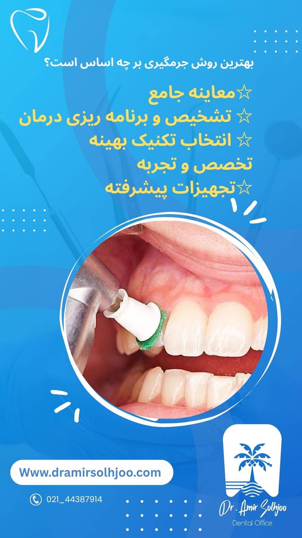 بهترین روش جرمگیری دندان