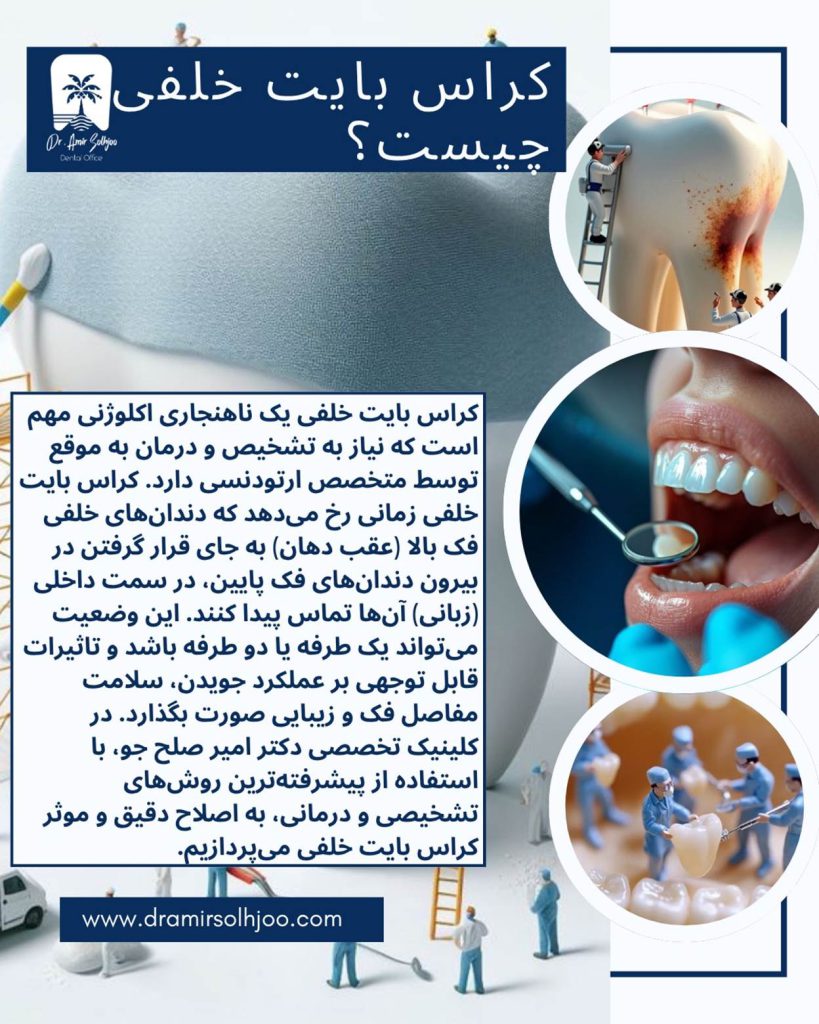 کراس بایت خلفی