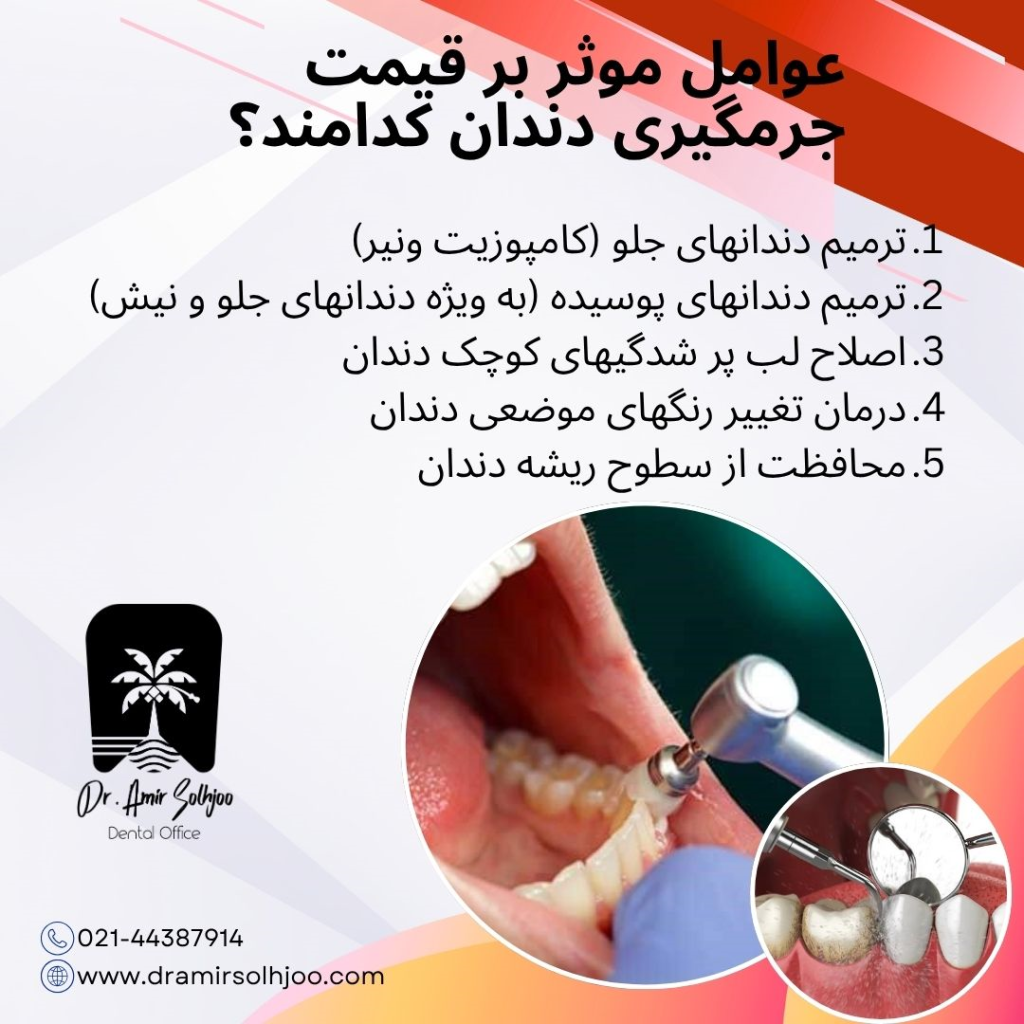 عوامل موثر بر قیمت جرمگیری دندان