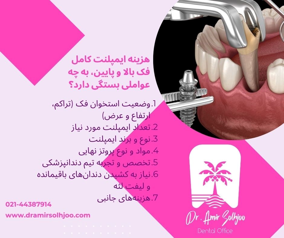 هزینه ایمپلنت کامل فک بالا و پایین