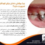 هزینه روکش دندان کودکان