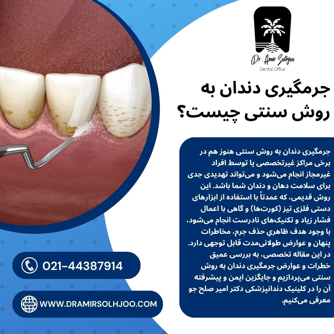 جرمگیری دندان به روش سنتی چیست
