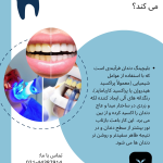 بلیچینگ در مرزداران