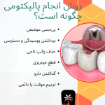 تفاوت پالپکتومی و عصب کشی