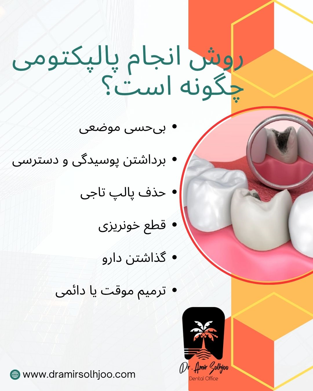 تفاوت پالپکتومی و عصب کشی