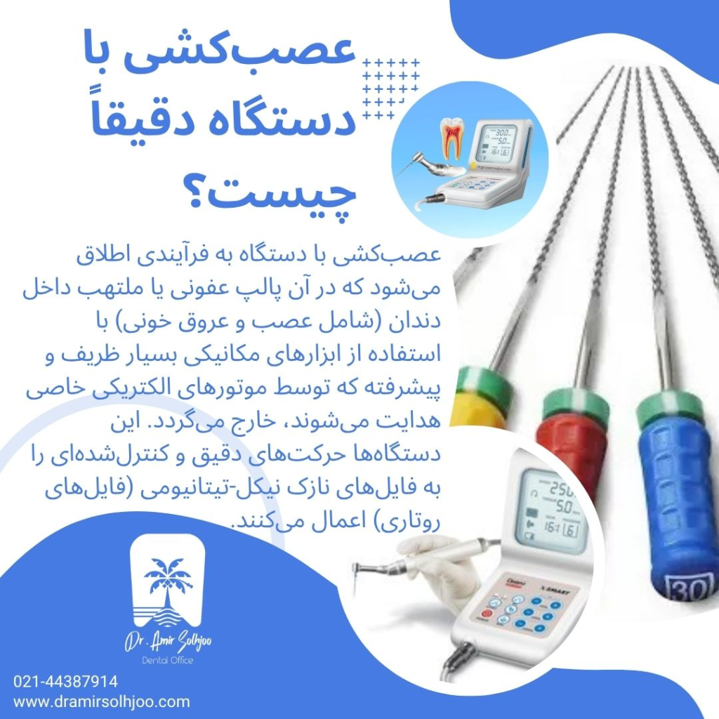 عصب کشی با دستگاه چیست