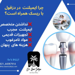 ایمپلنت دندان در دزفول
