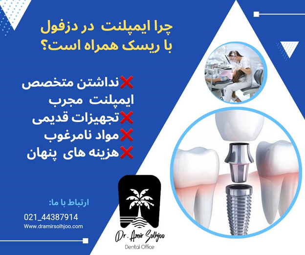 ایمپلنت دندان در دزفول
