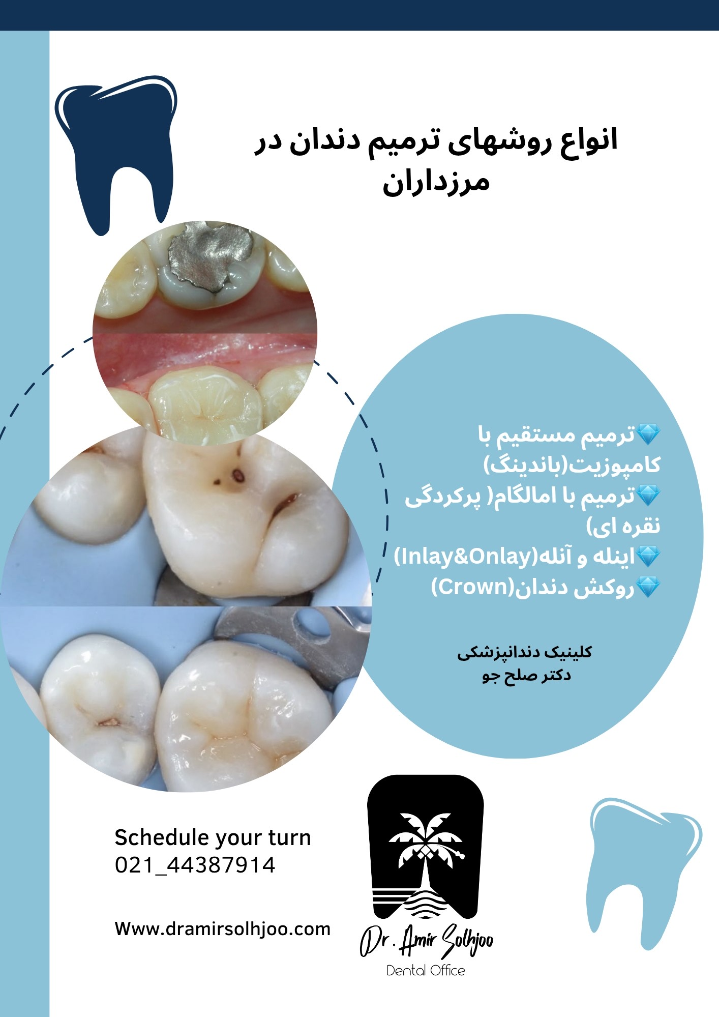 ترمیم دندان در مرزداران