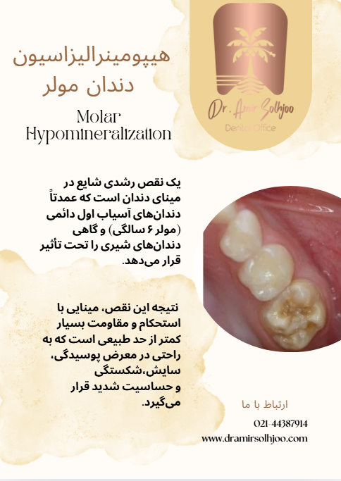هیپومینرالیزاسیون دندان مولر