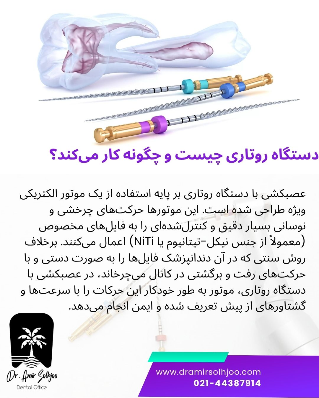عصب کشی با دستگاه روتاری