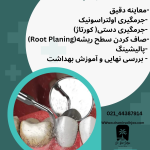 انواع جرم دندان