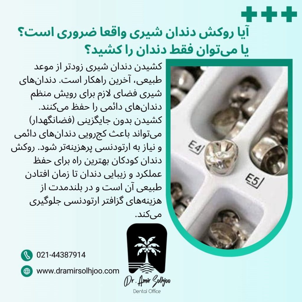 هزینه روکش دندان کودکان