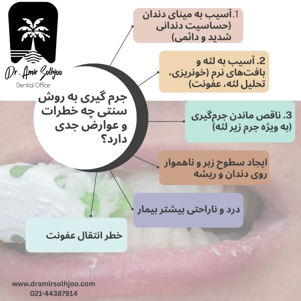 جرمگیری به روش سنتی