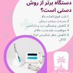 عصب کشی با دستگاه