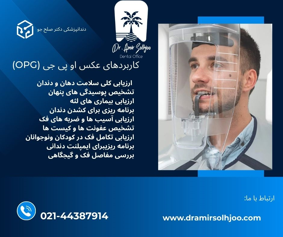 عکس opg در مرزداران