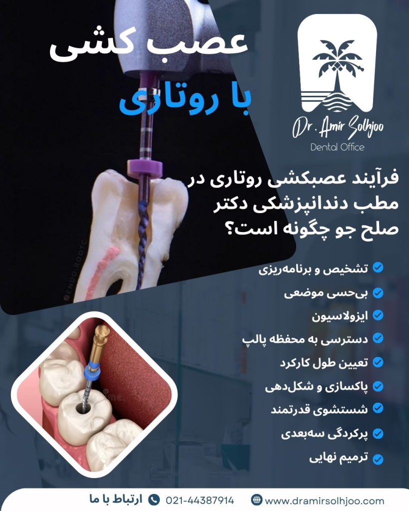عصب کشی با دستگاه روتاری