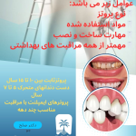 پروتز دندان