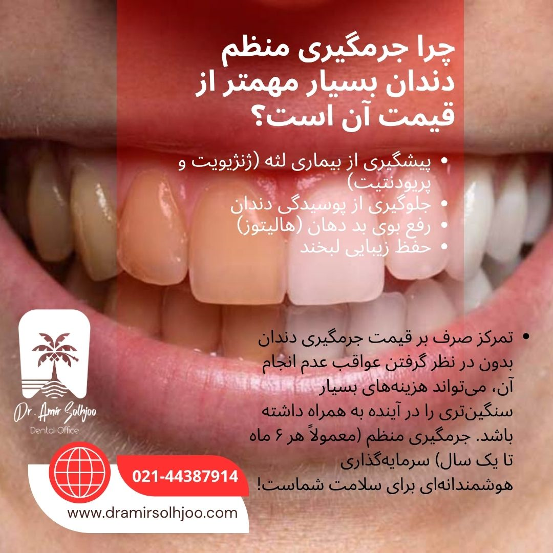 قیمت جرمگیری دندان