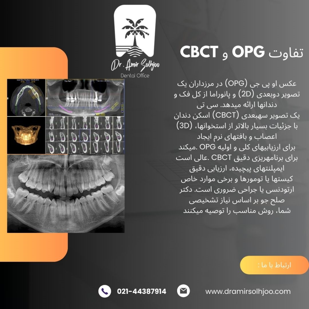 تفاوت cbct و opg