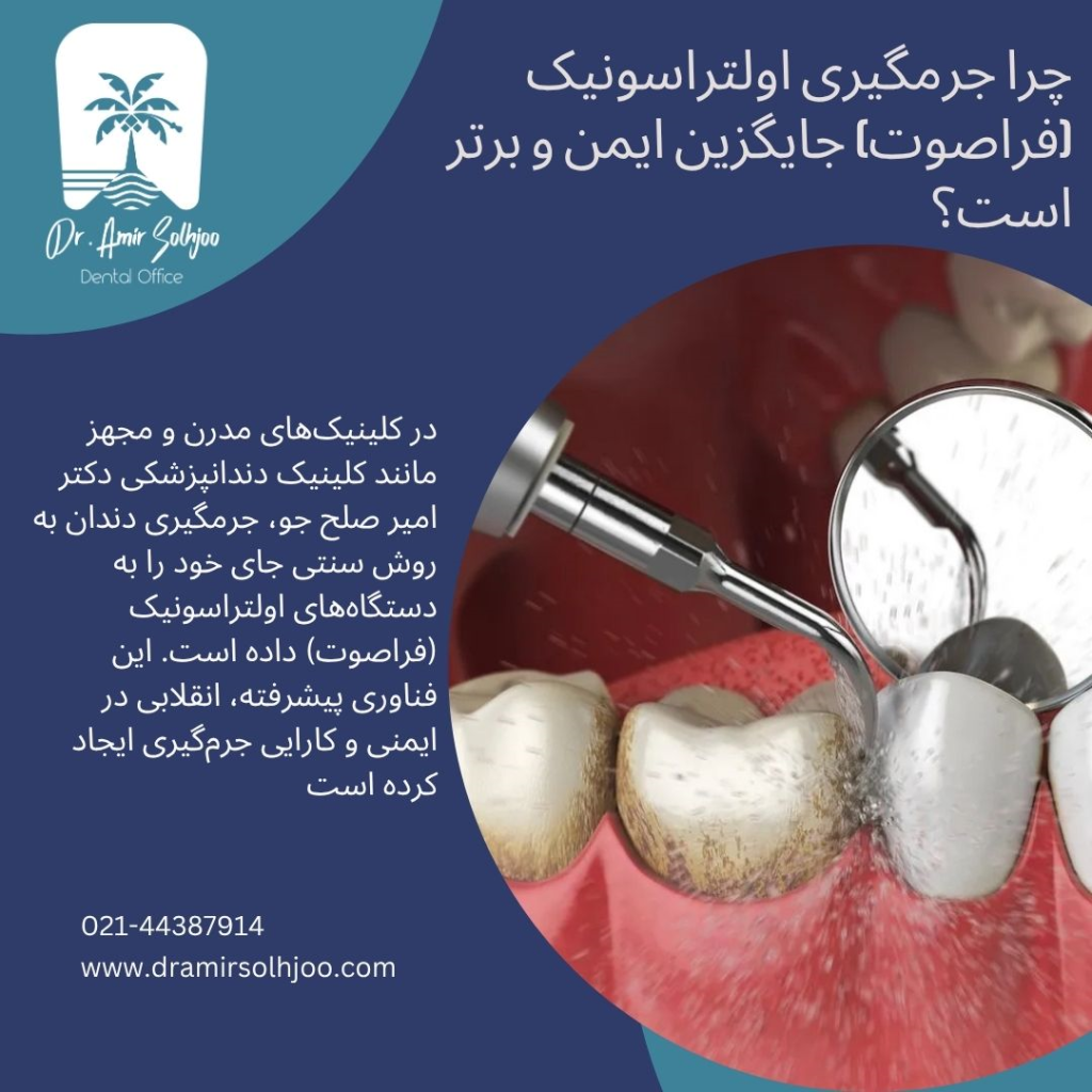 جرمگیری اولترا سونیک