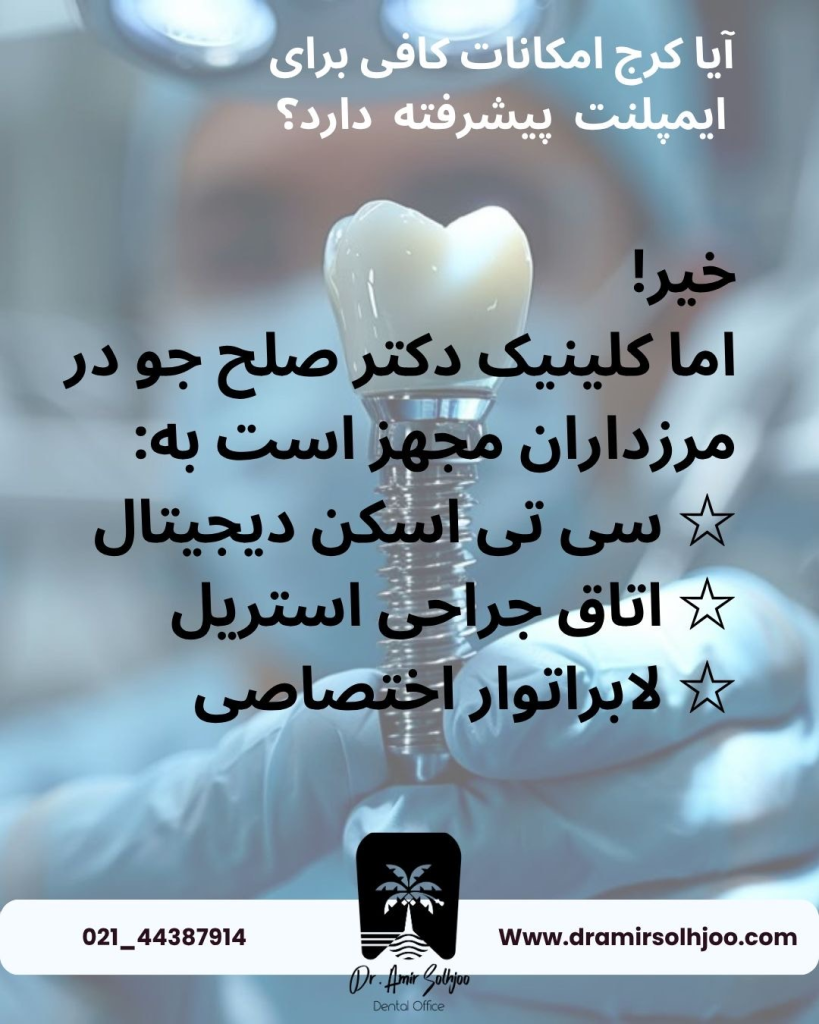 ایمپلنت دندان در کرج