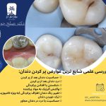 عوارض پر کردن دندان