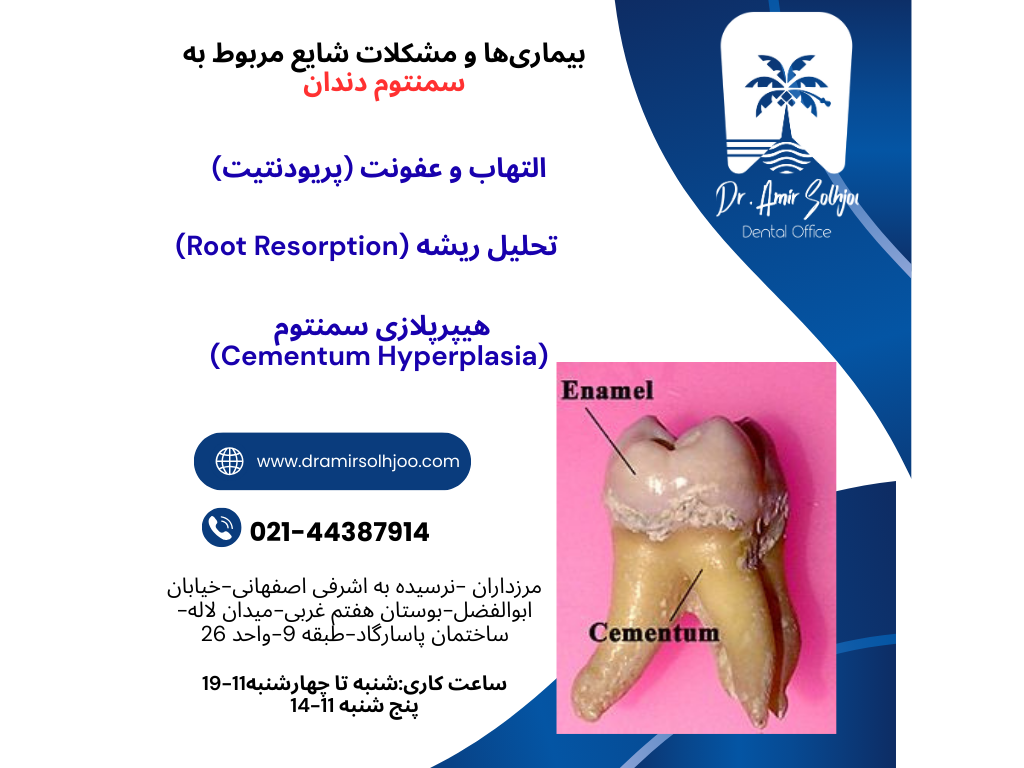 سمنتوم دندان چیست