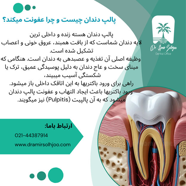 پالپ دندان چیست