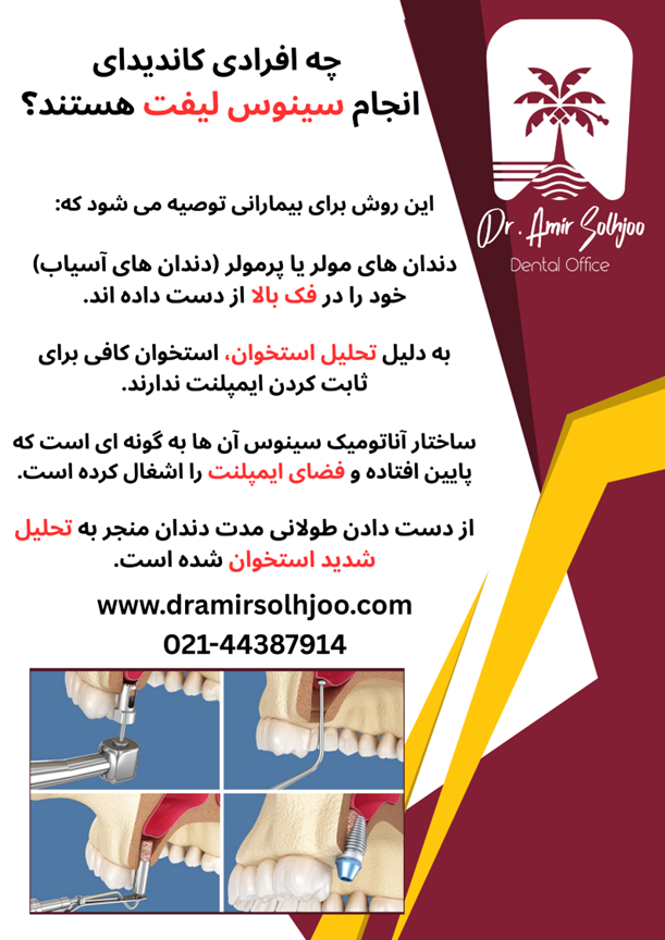 جراحی سینوس لیفت