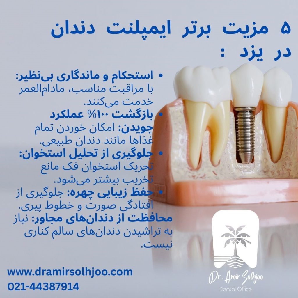 ایمپلنت دندان در یزد