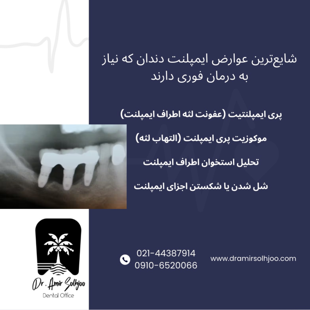 درمان عوارض ایمپلنت در مرزداران