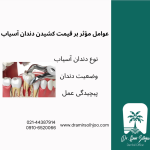 قیمت کشیدن دندان آسیاب
