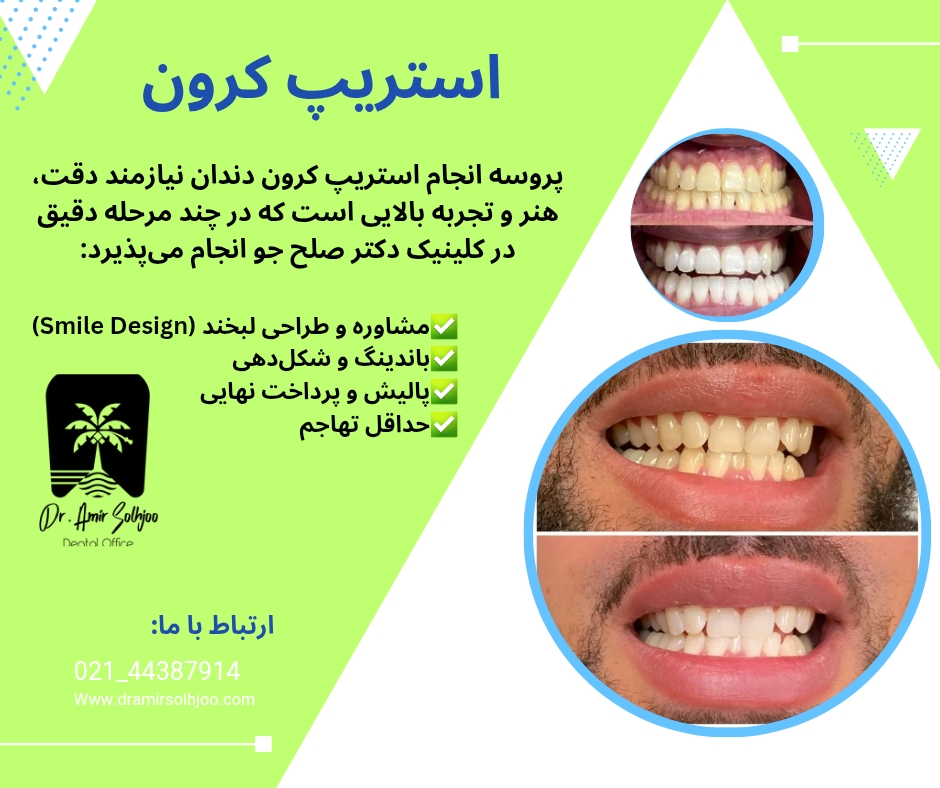 استریپ کرون چیست