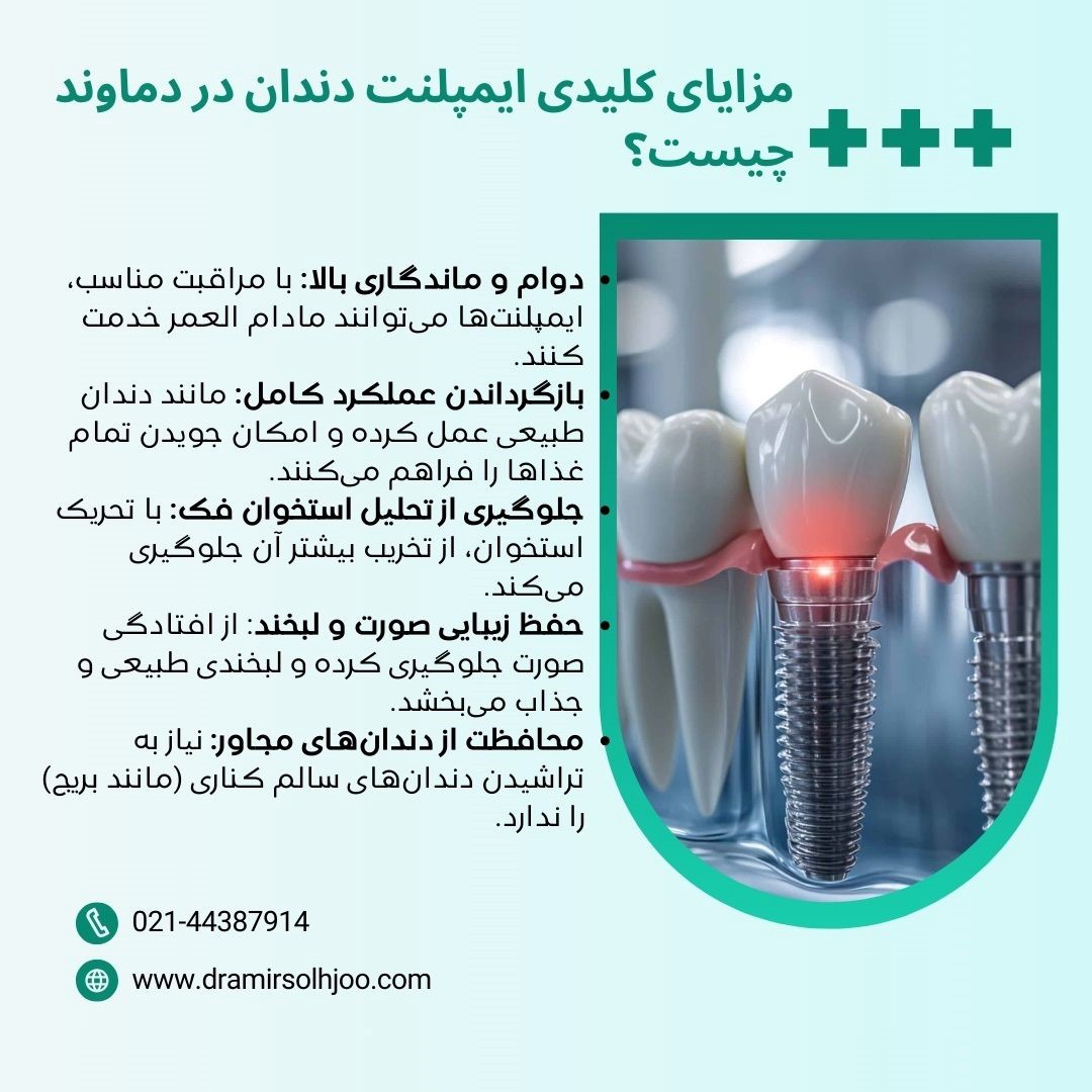 ایمپلنت دندان در دماوند