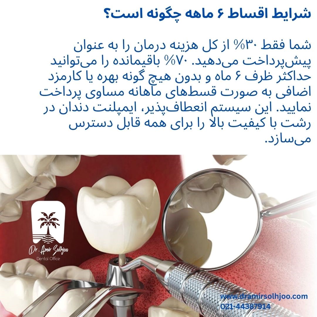 ایمپلنت دندان در رشت