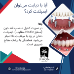 ایمپلنت دندان در یزد
