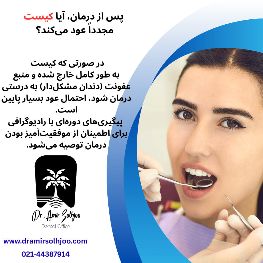 کیست پری اپیکال