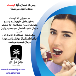 کیست پری اپیکال