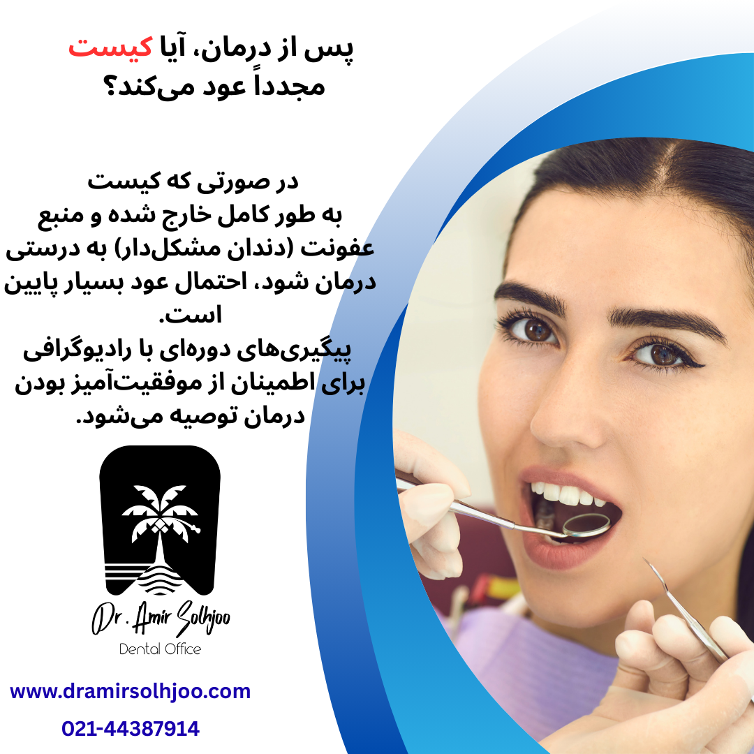 کیست پری اپیکال