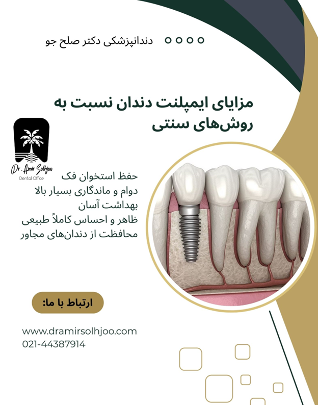 ایمپلنت دندان
