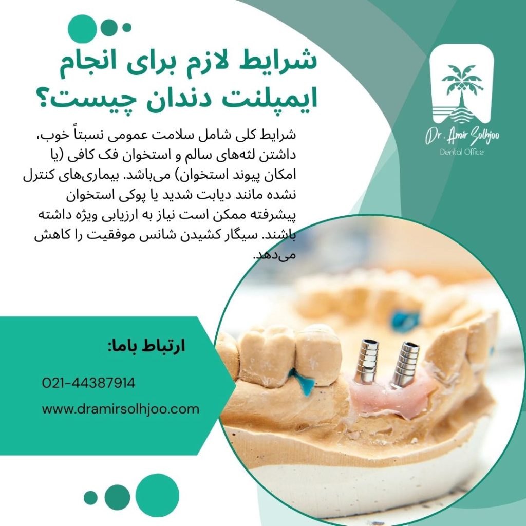 ایمپلنت دندان در دماوند